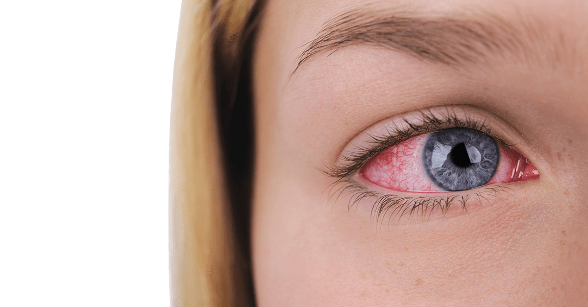 BloodVesselsInEye_1200