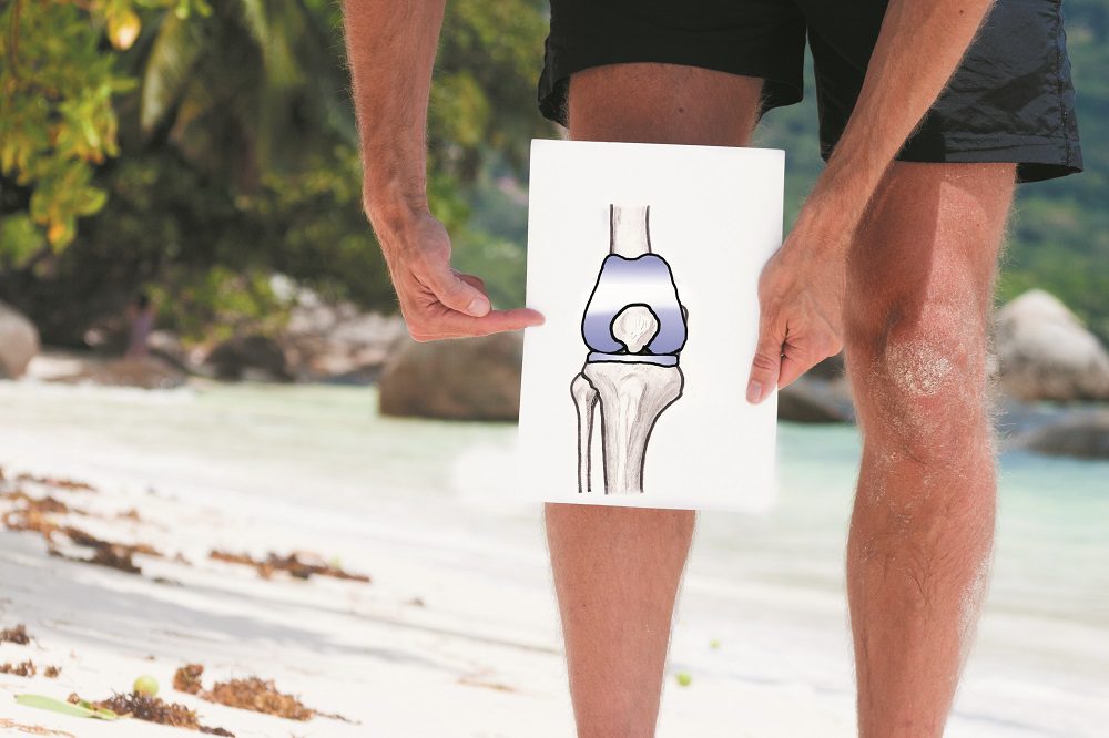 Total knee replacement